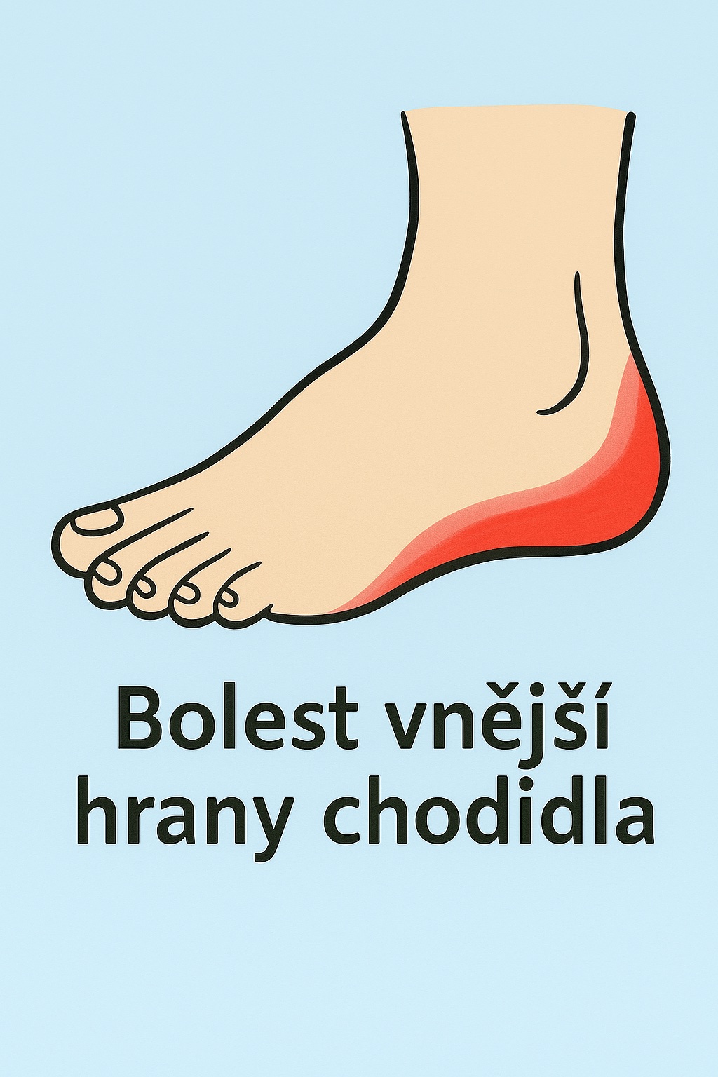 Bolest vnější hrany chodidla