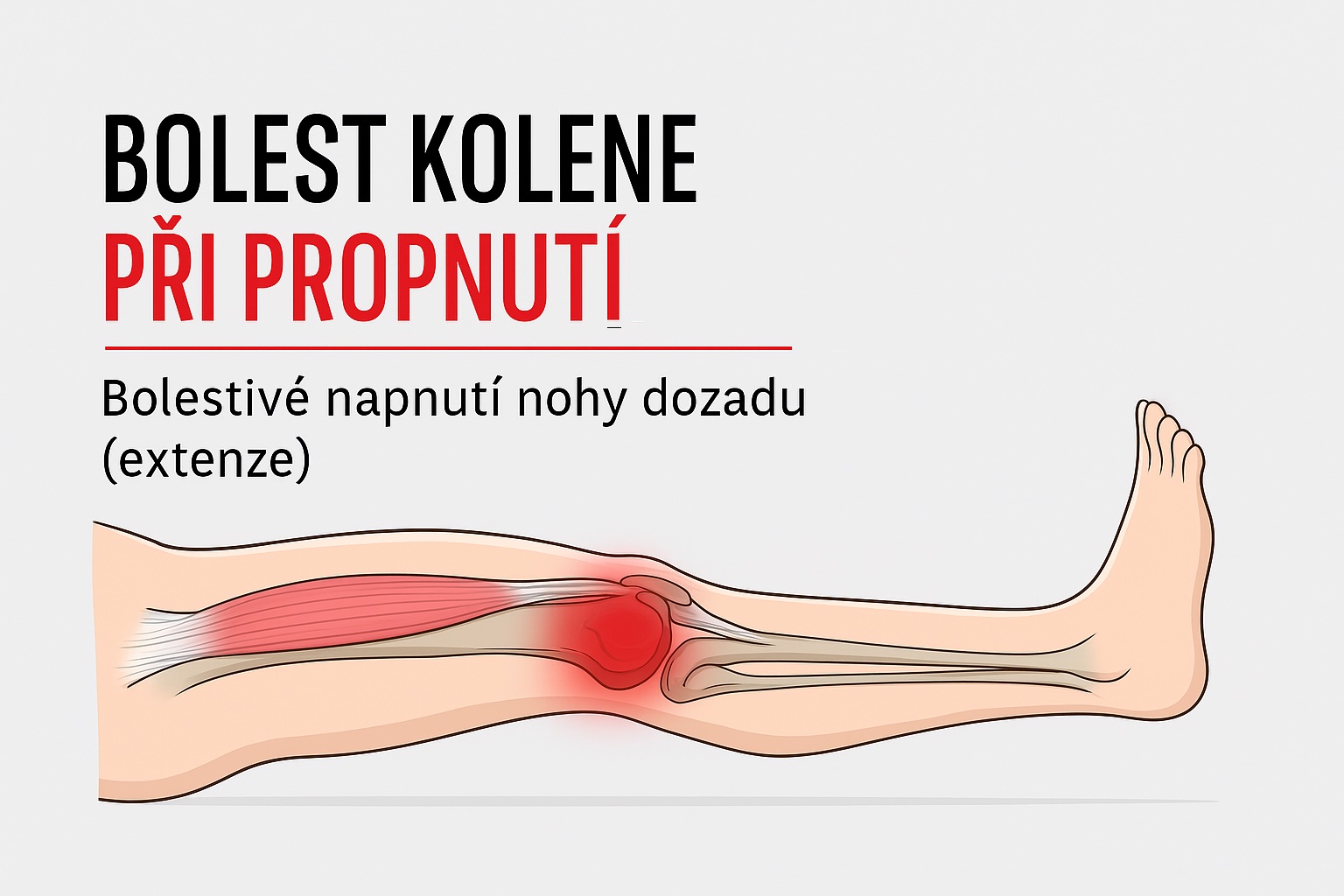 bolest kolene při propnutí