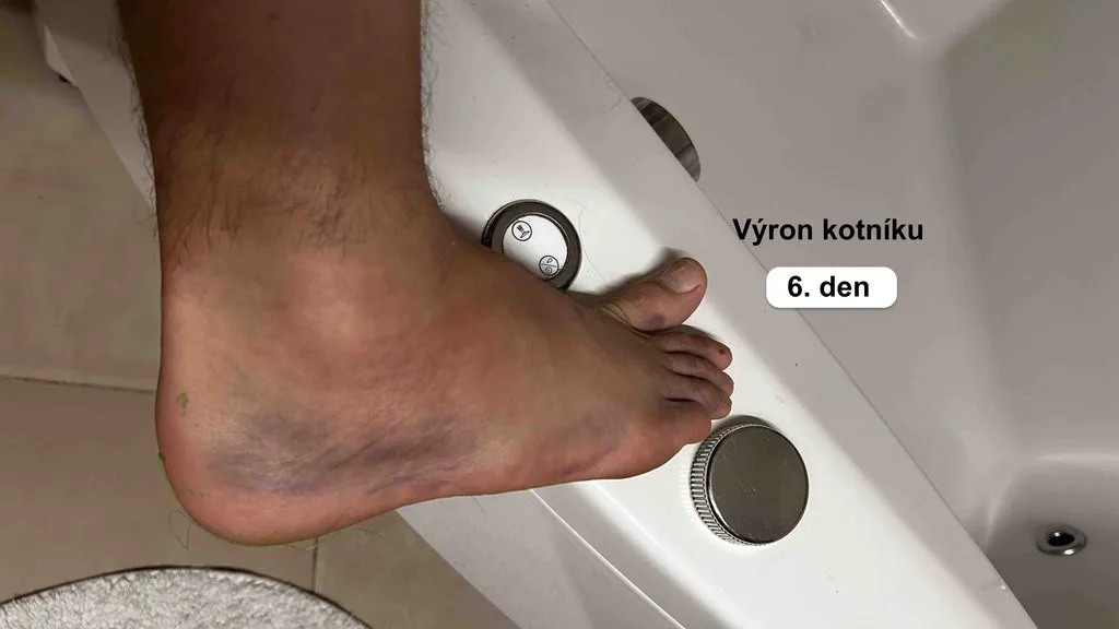 vyron kotniku